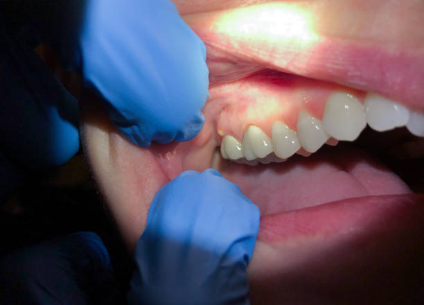 Best Broken Tooth Emergency  in Flatonia, TX